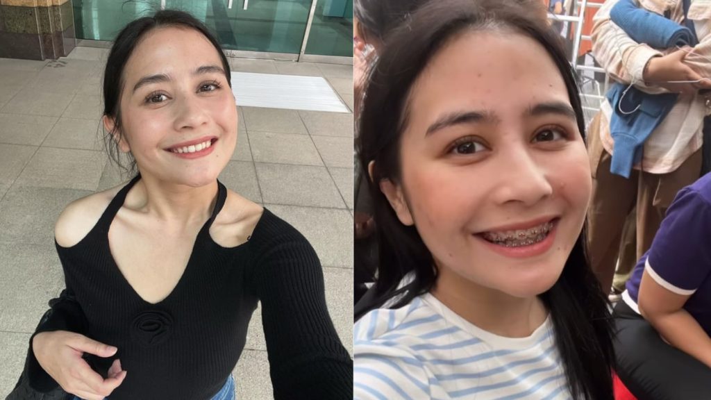 Prilly Latuconsina Berbagi Pengalaman Pakai Behel untuk Film Terbaru